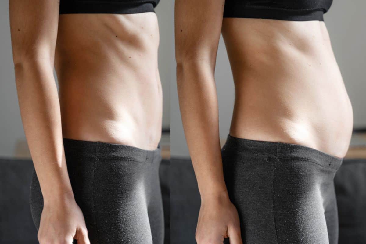 How long does diastasis recti take to improve Elstree Park?