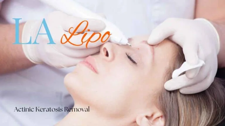 Woman receiving Actinic Keratosis Removal Treatment Elstree Park