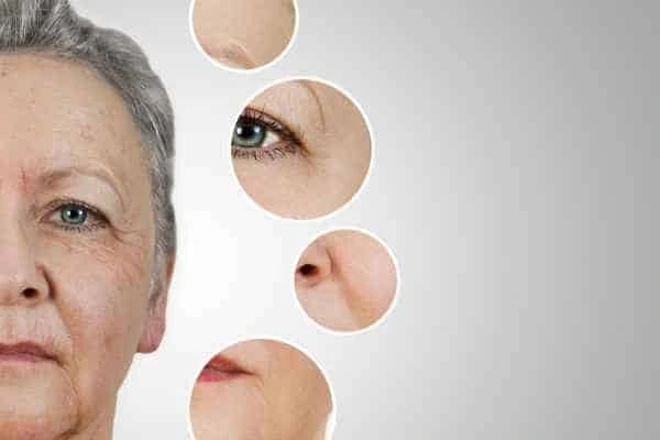 HIFU Facelift Elstree Park from LA LIPO