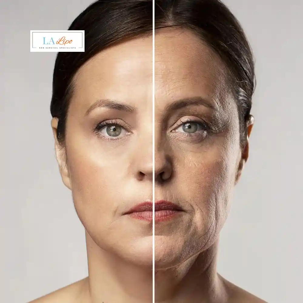How Can You Tell If Non-Surgical Skin Tightening Is Right for You Elstree Park?