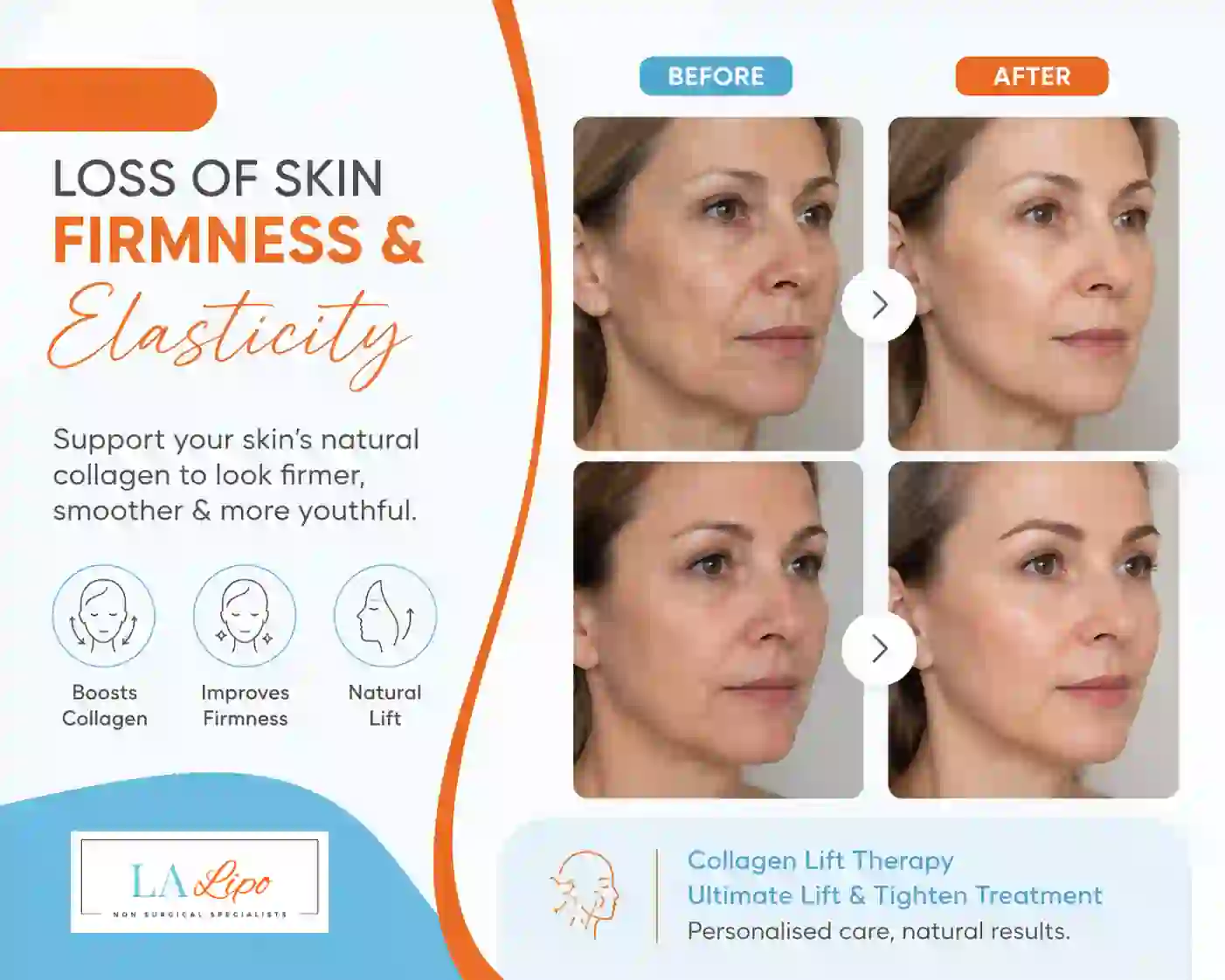 Sign #7: Loss of Skin Firmness and Elasticity Elstree Park