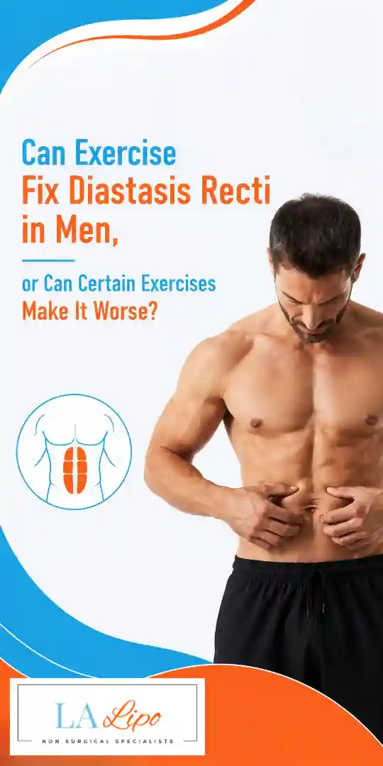 Can Exercise Fix Diastasis Recti in Men, or Can Certain Exercises Make It Worse Elstree Park?