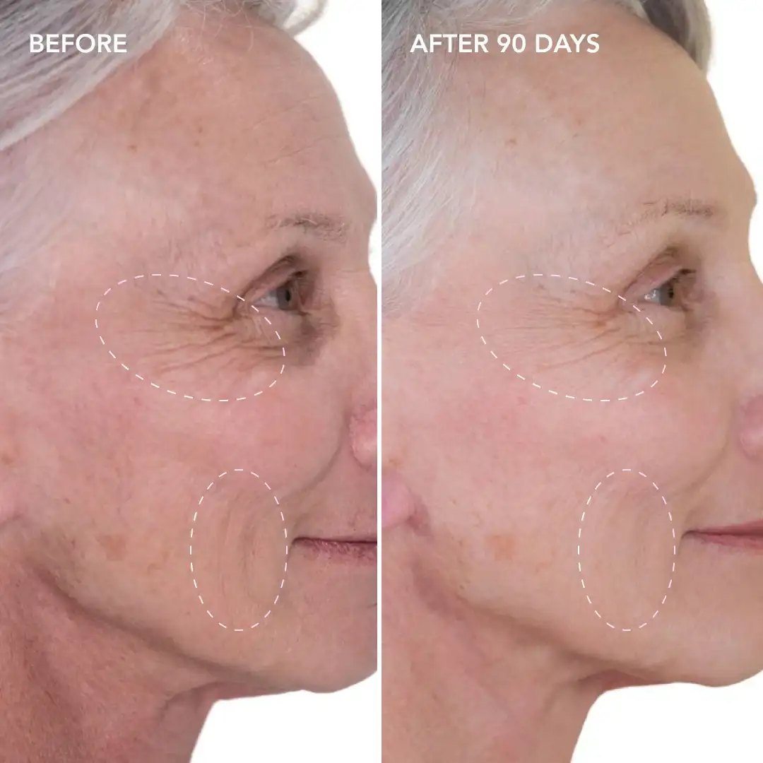 When will you see results Elstree Park